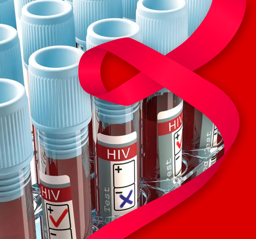 Say No to AIDS